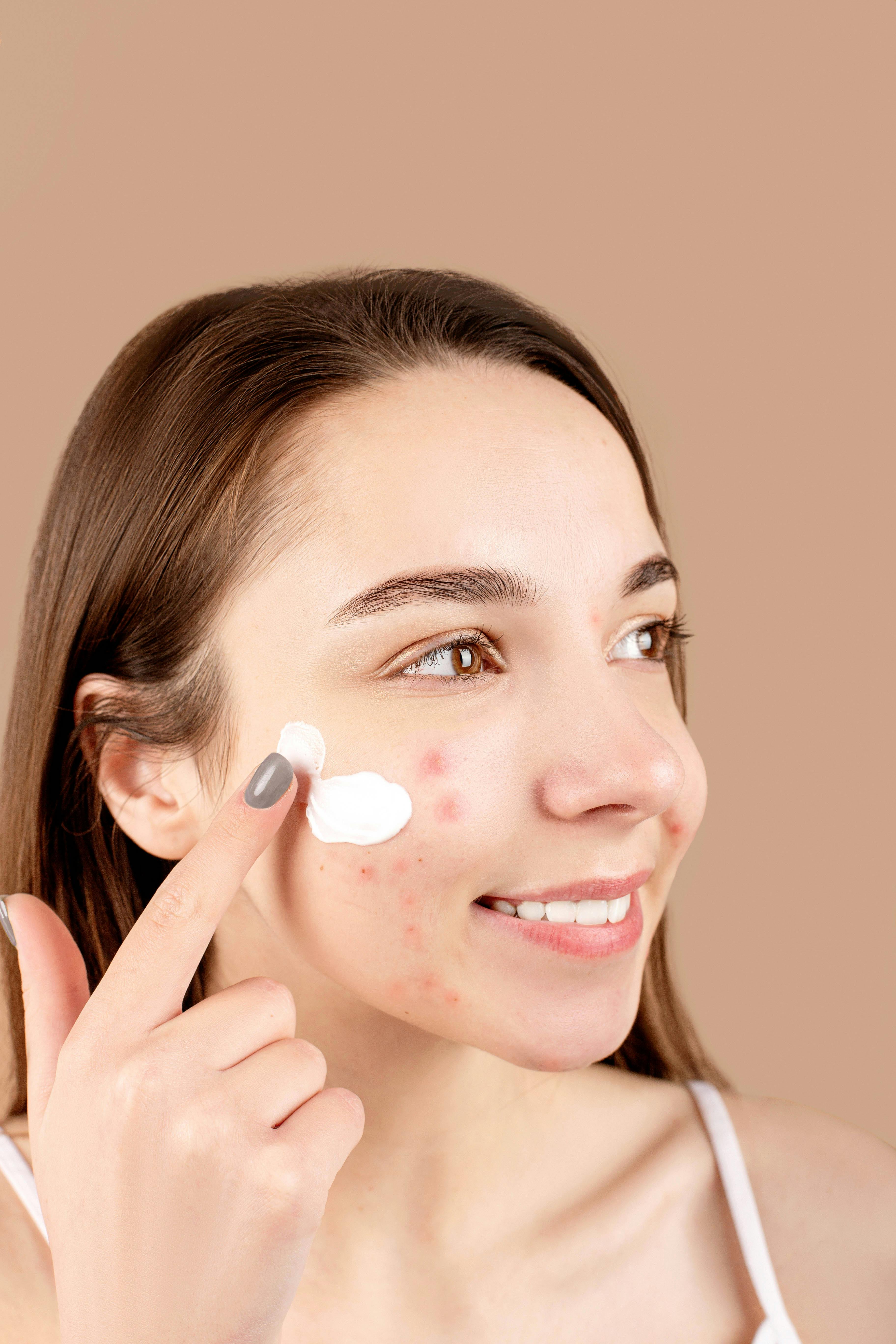 Acne da Mulher Adulta