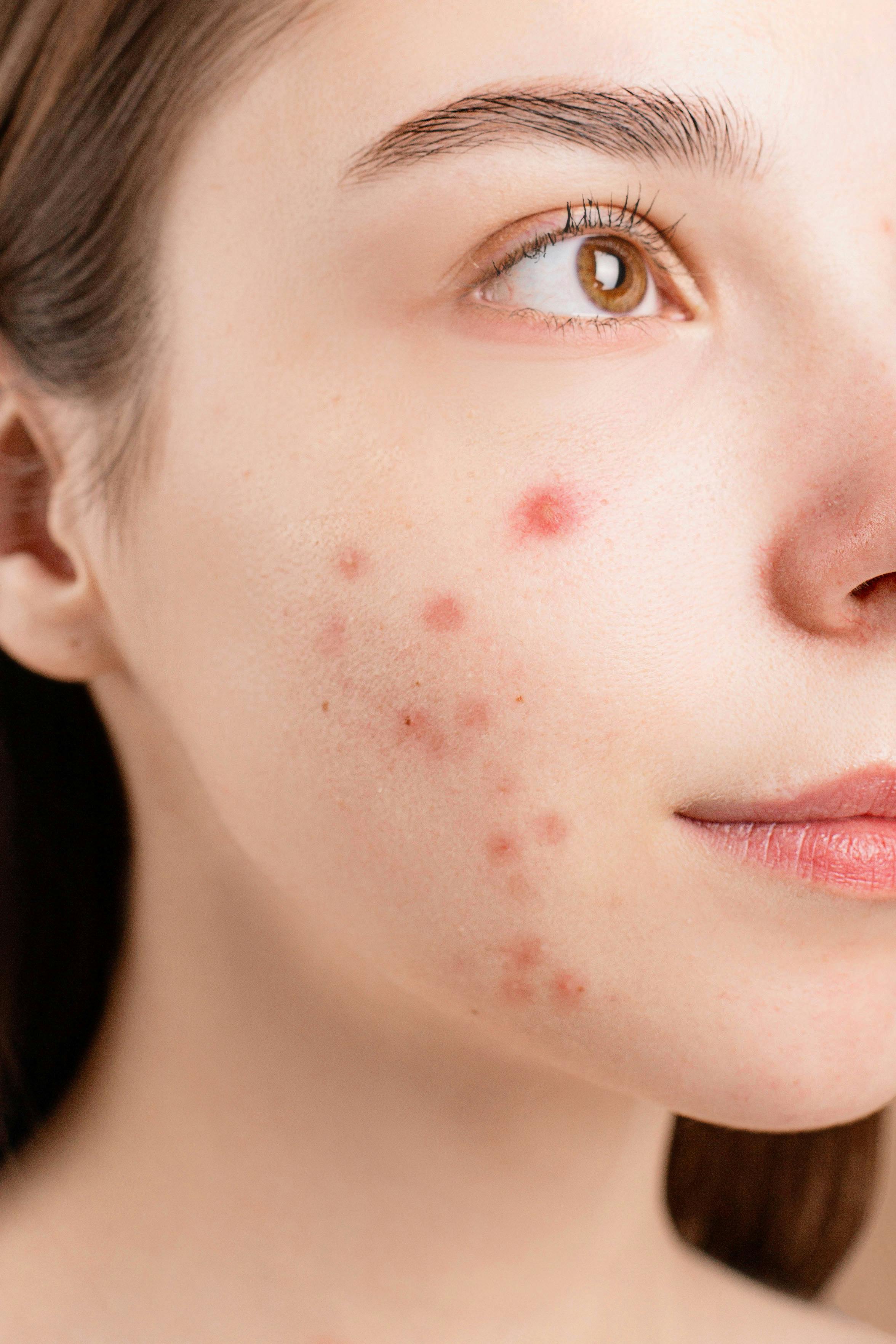 Avaliação dermatológica em consultório