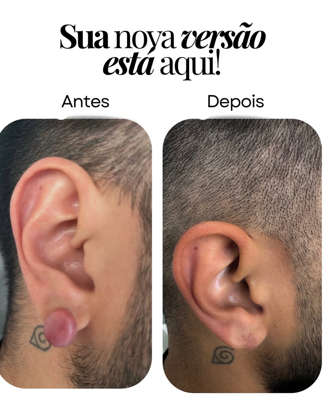 Post do Instagram