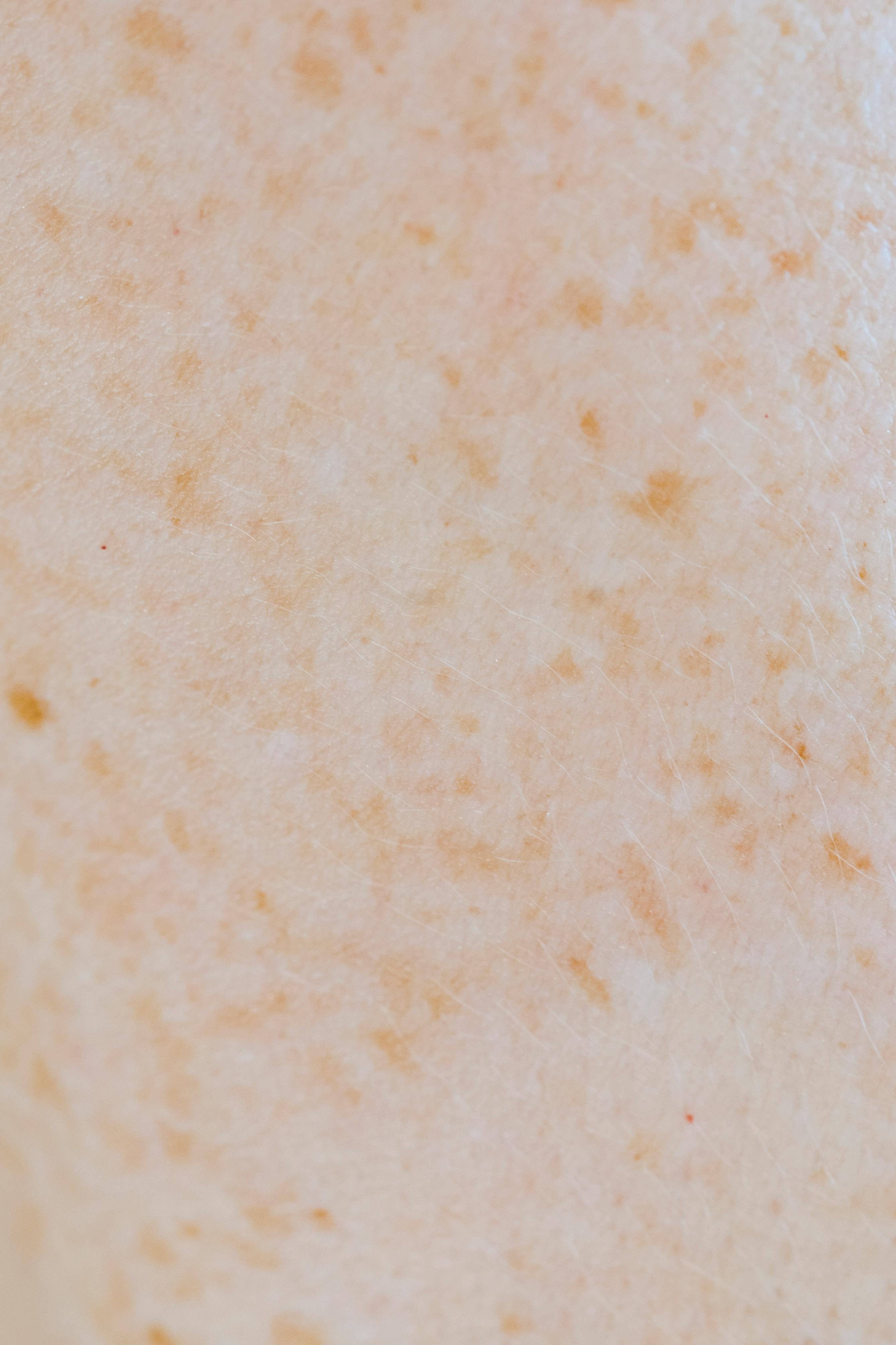 Avaliação dermatológica em consultório