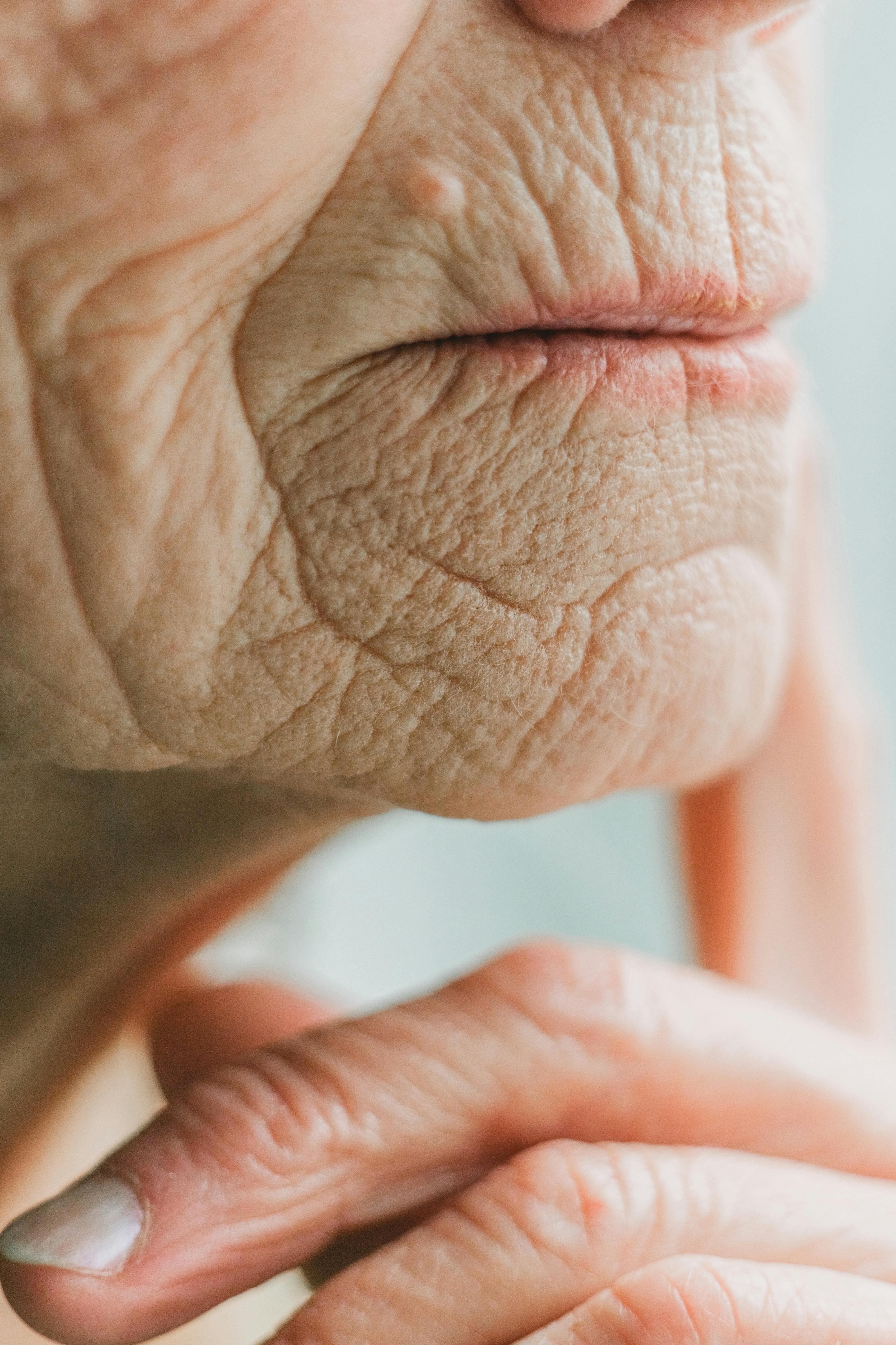 Procedimento dermatológico injetável